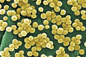 Methicillin-resistant Staphylococcus aureus