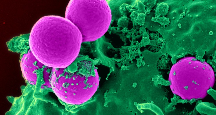 Tang - MRSA