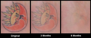 Gomes - Tatoo5