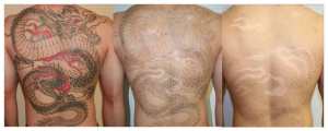 Gomes - Tatoo6