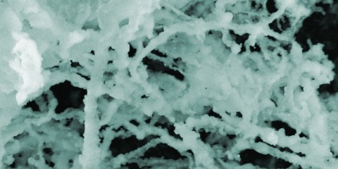 5941039768_9963f93fc1_o