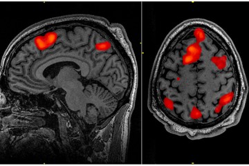 fMRI brain scan