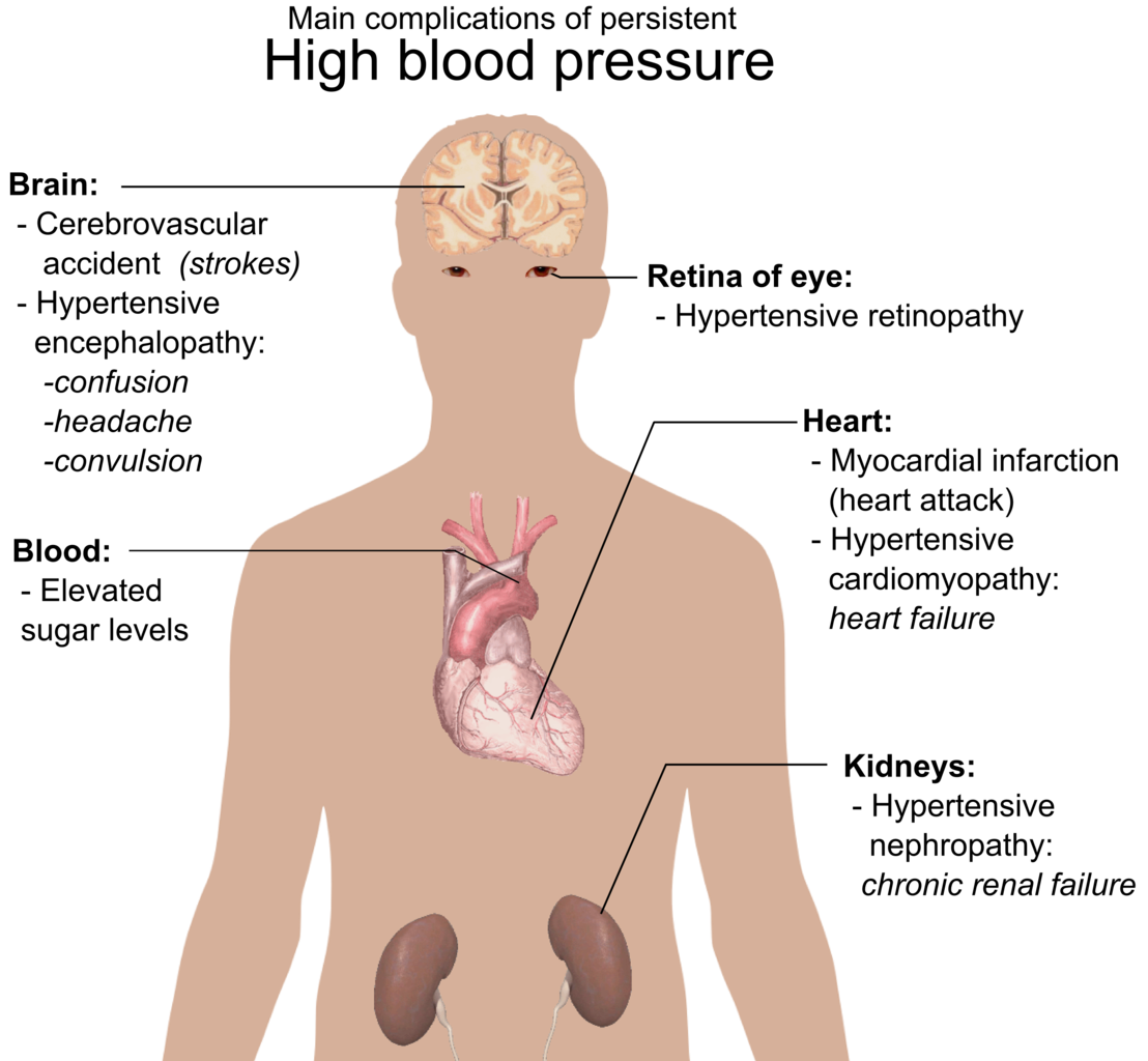 1108px-Main_complications_of_persistent_high_blood_pressure